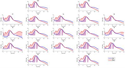 Who's driving? The default mode network in healthy elderly individuals at risk of cognitive decline